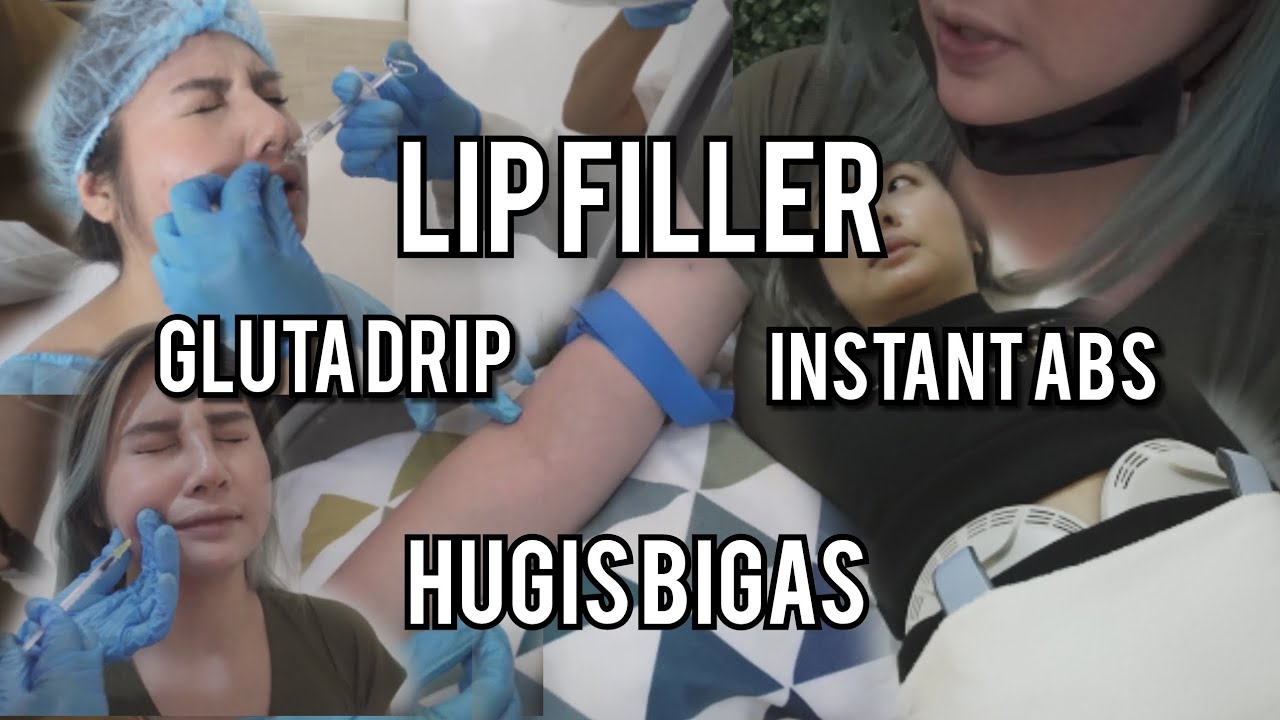 Lip Fillers + Gluta Drip + Emsculpt + Mesolipo at ROYAL AESTHETICS
