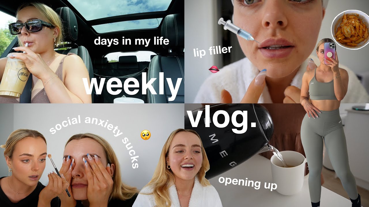 WEEKLY VLOG | lip filler top up | social anxiety sucks 🥲 days in my life | meals |  Conagh Kathleen