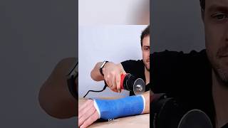 Don’t Cut Your Cast at Home! 😳⚠️