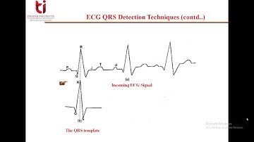 Series 2 Lecture 6 ECG Parameters and their Estimation