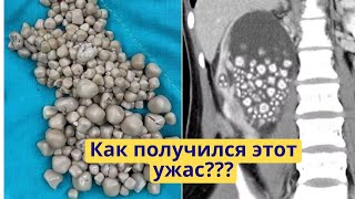 Всем любителям газировки, чая и кофе посвящается!