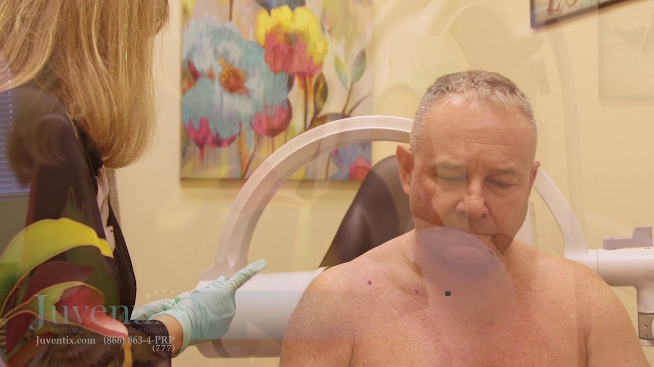 Juventix PRP Instructions: Shoulder PRP Injection