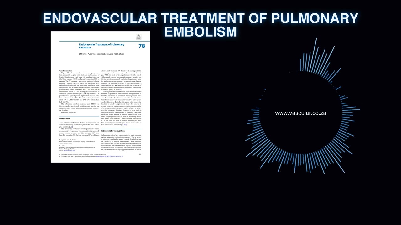 MET - 78 - Endovascular Treatment of Pulmonary Embolism - Deep Dive Podcast