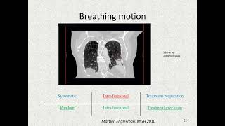 motion management ( radiotherapy )