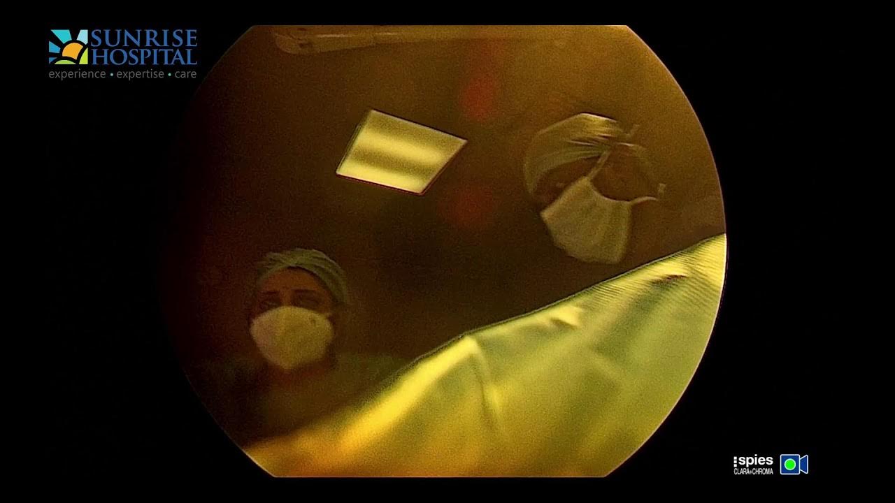 Laparoscopic Excision of atretic cervix and upper vagina