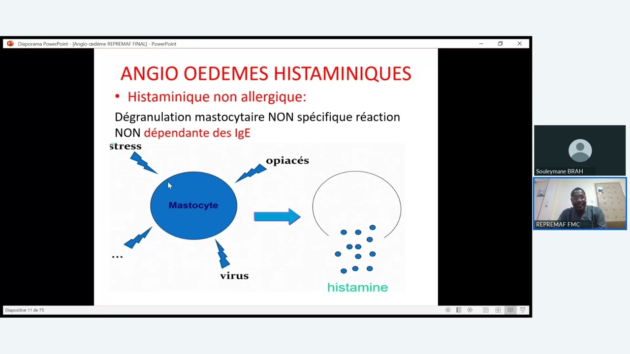 Webinaire/ Repremaf   Angio oedème héréditaire en Afrique  Mise au Point ( Dr Tahirou Hamidou)