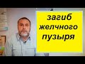 Загиб желчного пузыря. Почему возникает. Как можно полноценно вылечить.