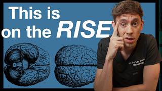 What is Idiopathic Intracranial Hypertension? (neurologist explains)