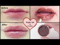 How to get bigger lips in just 5 mins | Mamtha Nair
