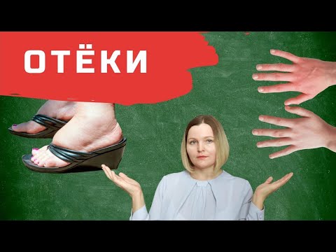 Отёки на кето