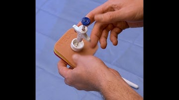 Weck® EFx Classic™ Fascial Closure Inservice Demo