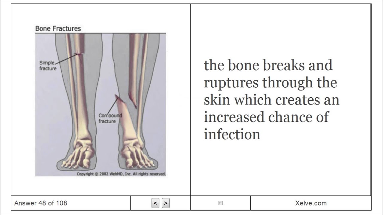 Introduction to Human Anatomy and Physiology - 5 The Skeletal System