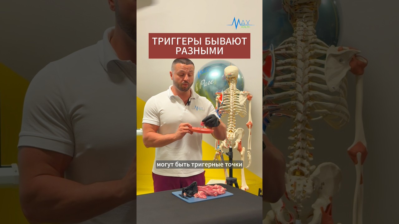 Триггеры бывают разными - по размеру, форме и локации.