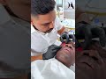 #TearTrough #EndolaserPro #UnderEyeRejuvenation #AestheticTreatment #SkinTightening