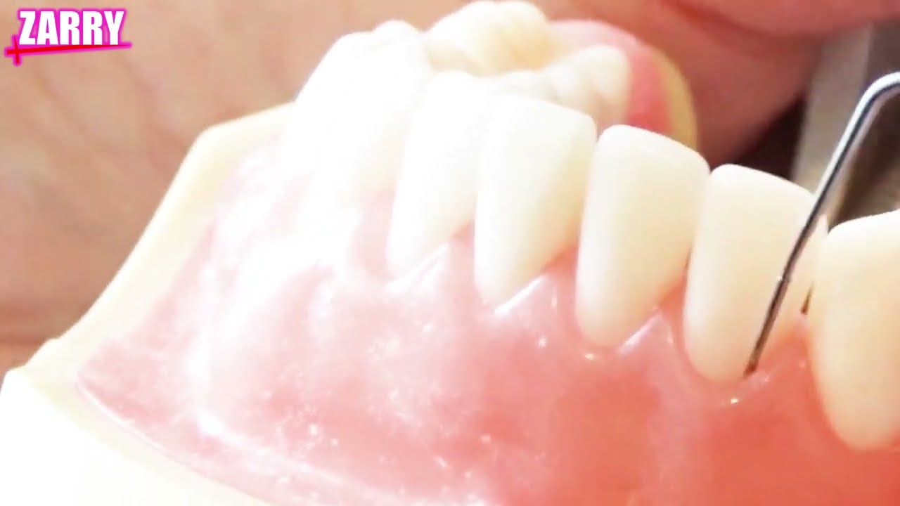 【土屋和子先生】プロービングのやり方と力加減。