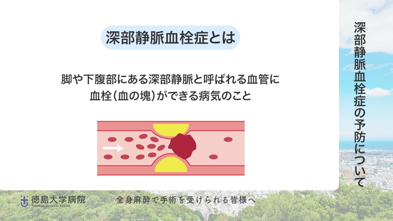 07 深部静脈血栓症の予防について - YouTube