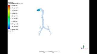 Traveling Of Single Micron-Sized Drug Particles From Mouth Through Respiratory Tract