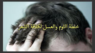 خلطة الثوم والعسل لكثافة الشعر