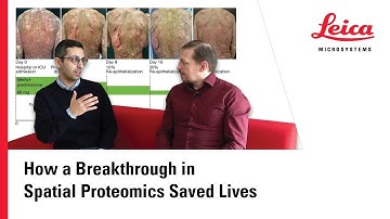 How a Breakthrough in Spatial Proteomics Saved Lives
