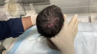 Nicu Baby Care Newborn Baby