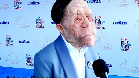 Adam Pearson arrives at the 2025 Film Independent Spirit Awards