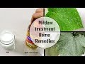 Home Remedy for Mild dew/ white fungus