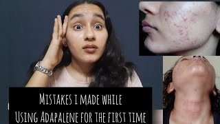 My Adapalene mistakes| Using too much product | Irritation,redness,dry skin| Khushi Mahla Resimi