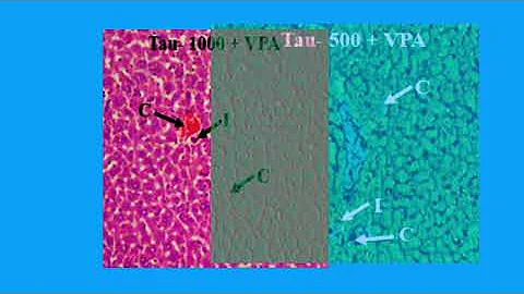 676E6CF397282B4AEB239152EDA3DD#1