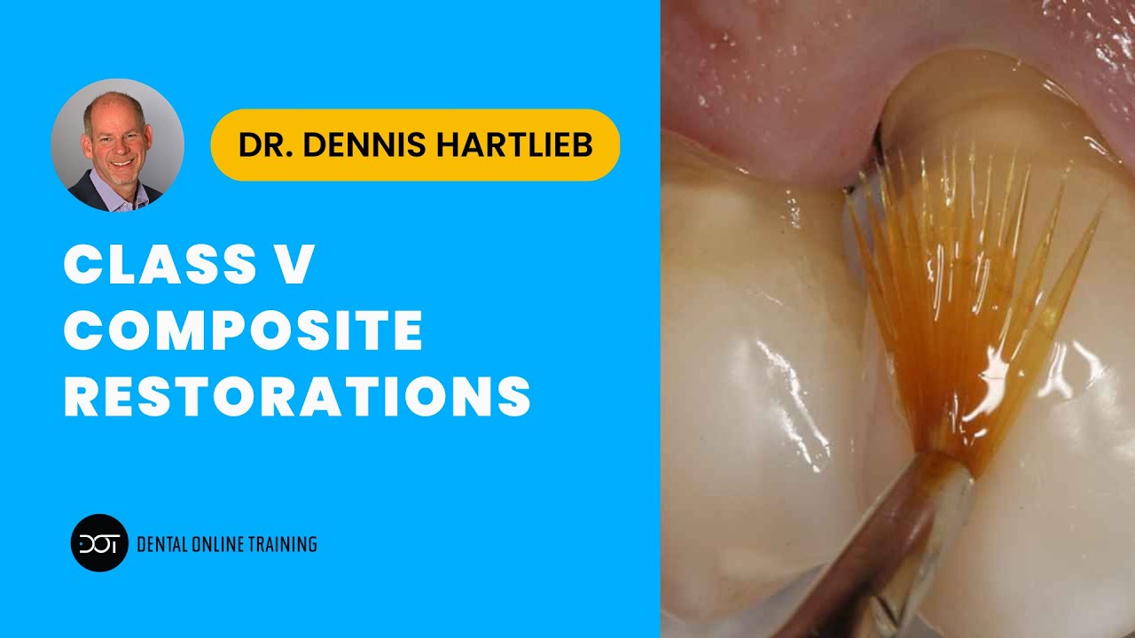 Class V Restoration Demonstration | Dental Online Training