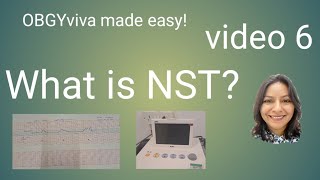 What Is Nst? Obgy Viva Made Easy Video 6