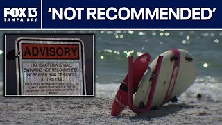 Pinellas beaches see high levels of bacteria