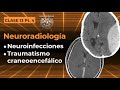 13.4 -  Neuroradiología: Neuroinfecciones y Traumatismo Craneoencefálico
