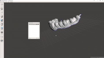 Meshmixer - Dental models: from intraoral scan to 3D Printer