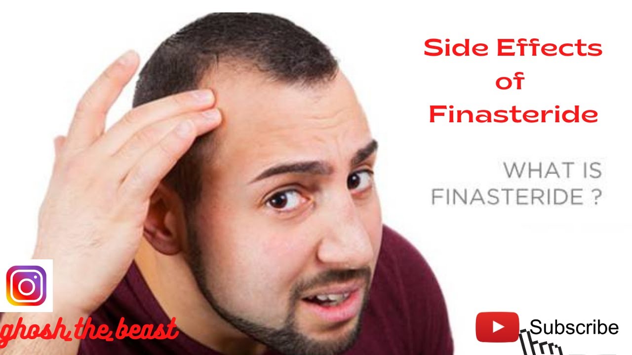 Finasteride and dutasteride side effects youtube