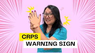 Why Your Hand Is Still Swollen Months After an Injury (CRPS Warning Sign)