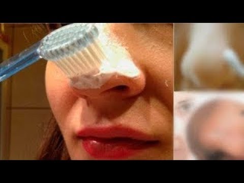 فيديو: كيف تتوقف عن حك أنفك