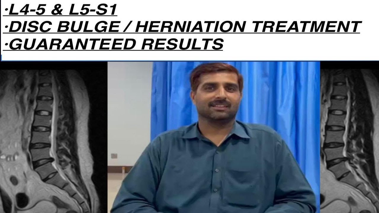L4-L5 L5-S1 Disc Bulge/Herniation Treatment Without any surgery or Medication.