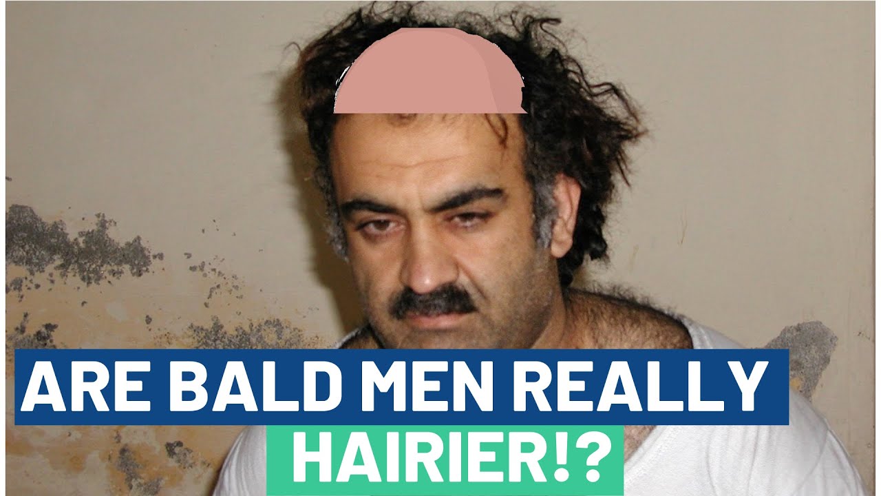 Are Bald Guys Really Hairier?