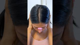 Products Tips For Dry Scalp 