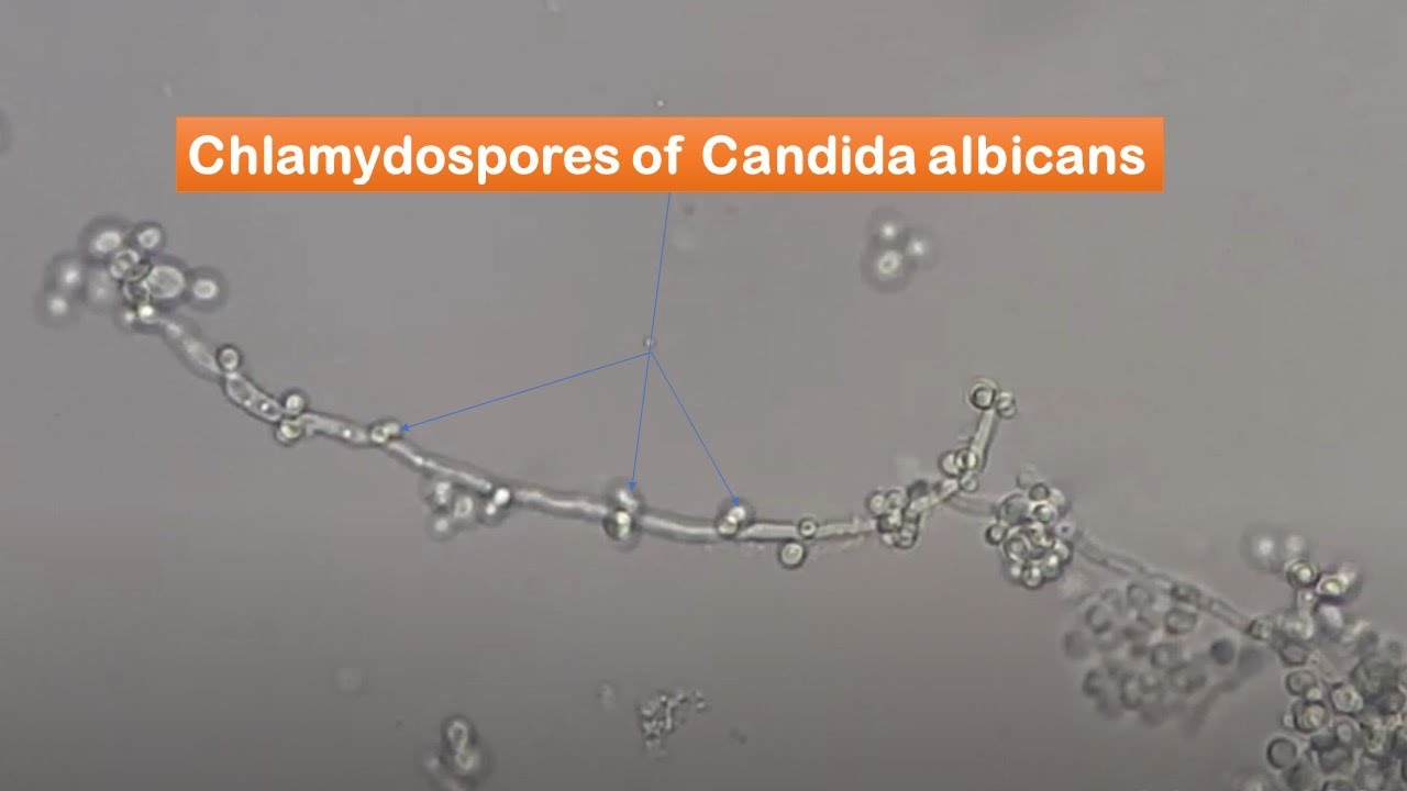 Chlamydospores of Candida albicans observation - YouTube