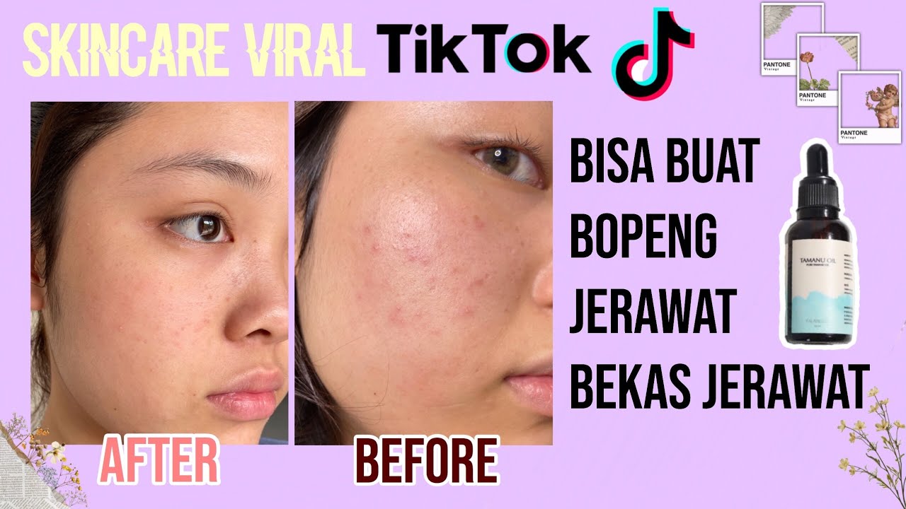 Skincare Viral Tiktok Tamanu Oil Review Youtube