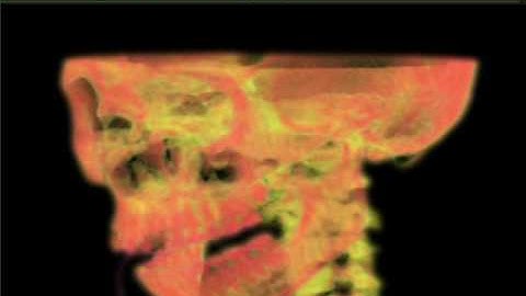 Esperient Creator: Volumetric MRI Data Visualization