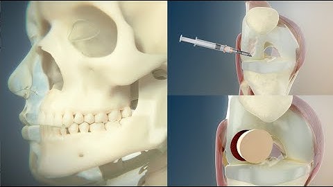 EpiBone | Product Trailer