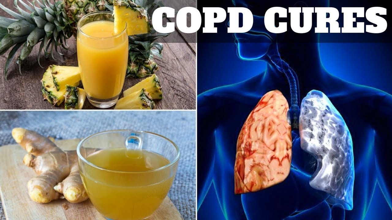 COPD Chronic Obstructive Pulmonary Disease Treatment How to Cure