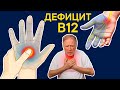 Что творит ДЕФИЦИТ B12 с организмом? В чем причина? Как бороться с дефицитом?