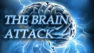 The Brain Attack