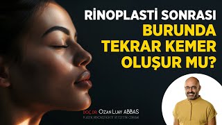 Rinoplasti Sonrası Burunda Tekrar Kemer Oluşur mu? | Doç. Dr. Ozan Luay ABBAS