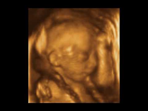 Andriana Baby 21 Weeks 3D 4D Ultrasound - Charlotte, NC