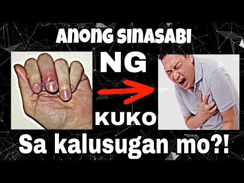 Video: Itim Na Mga Laso