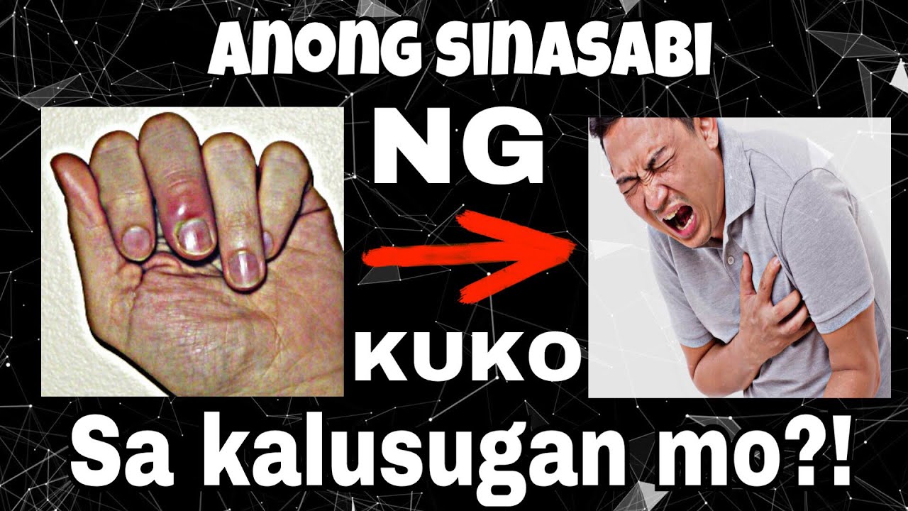 Tignan mo ang iyong mga kuko! Baka isa na dito ay sakit mo! - YouTube